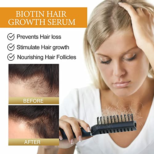 Gusta kosa hidratantna gusta protiv pada fiksna popravka kose korijen korijen korijen za kosu