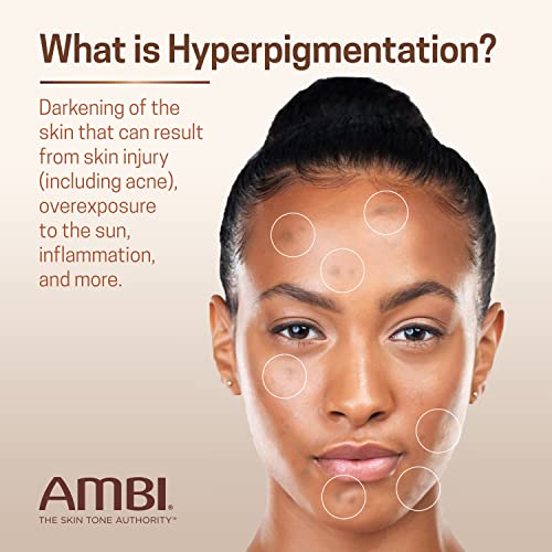 Ambi Even & Clear Advanced Fade krema, bez hidrokinona, tretman hiperpigmentacije, tvrdoglavi korektor tamne