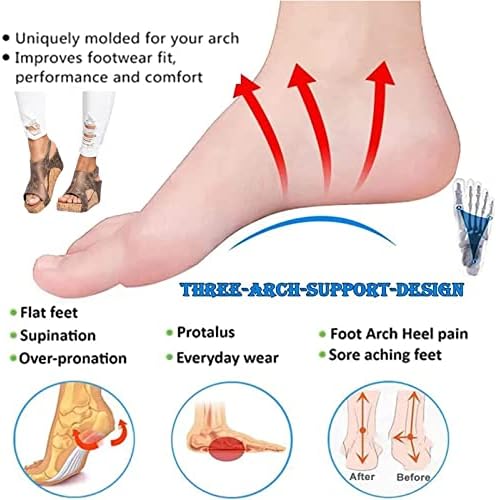 Nuanyoyo sjajne ortopedske sandale, melaredne sandale za pete, ortopedske lučne sandale, sa podesivim kazom