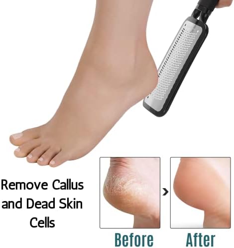 Slick-Foot turpija za uklanjanje kalusa, čistač stopala, odstranjivač kalusa za stopala, turpija za stopala,