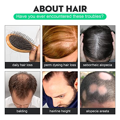 Muški Serum za kosu-hranjiva i obnavljajuća linija kose, gusta i čvrsta kosa 120ml